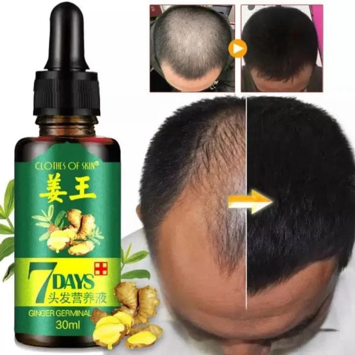 Ginger Germinal Oil For Hair Growth | 7 Days | Guaranteed Results | Fatest Hair Growth & Care | For Boys & Girls image 1